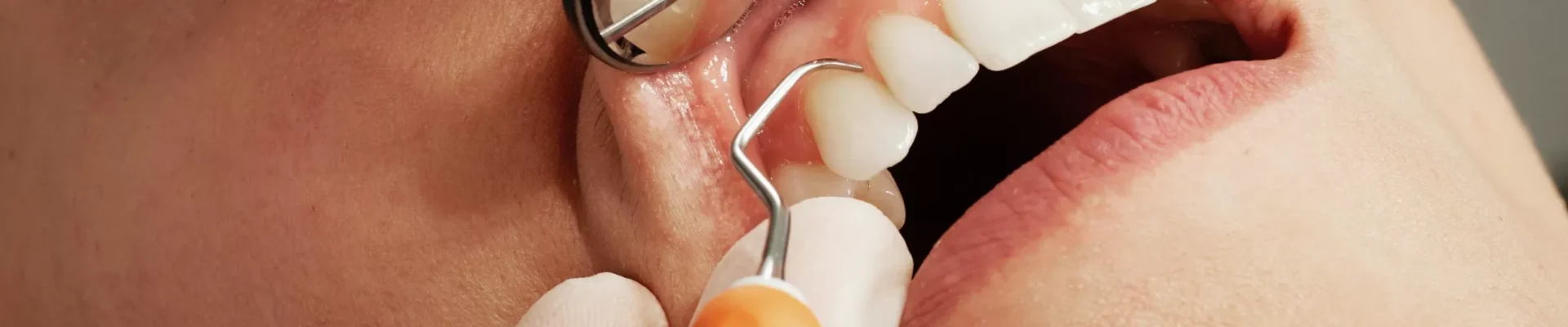 Unlocking Oral Harmony: The Interplay of Sound Therapy in Dentistry