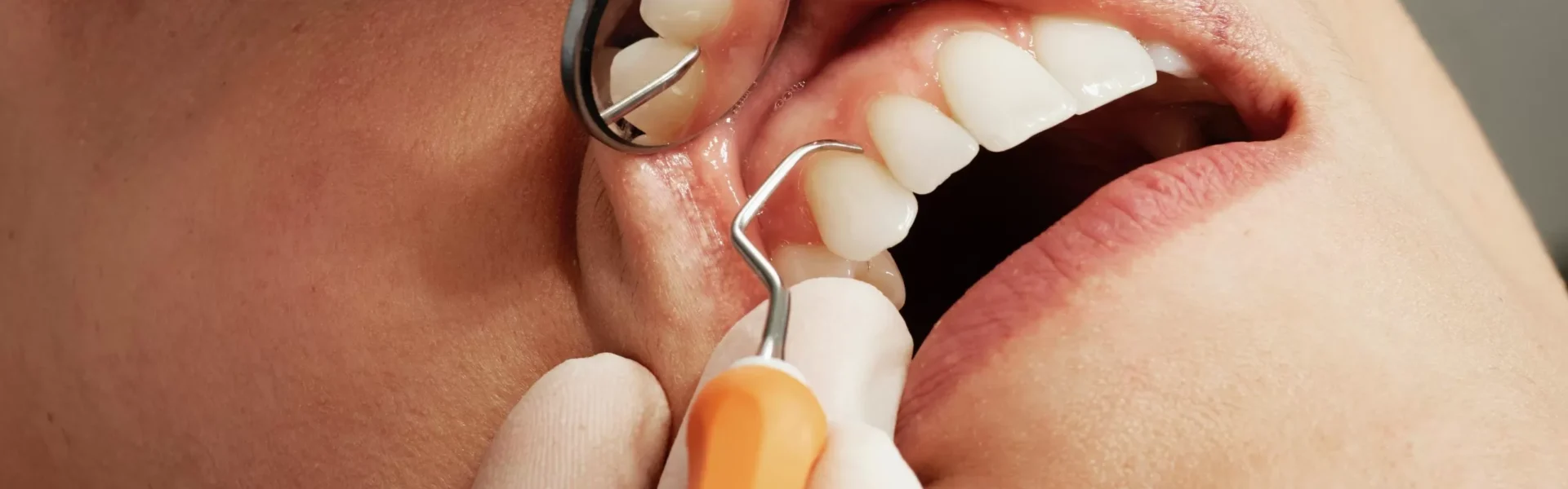 Unlocking Oral Harmony: The Interplay of Sound Therapy in Dentistry